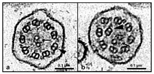 Electron micrographs of transverse sections of canine respiratory cilia